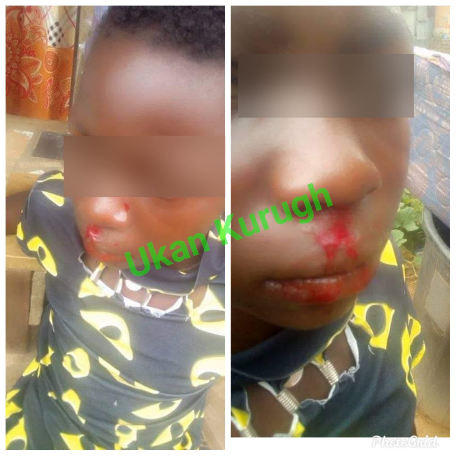 Girl allegedly battered by her stepsister in Benue (photos)