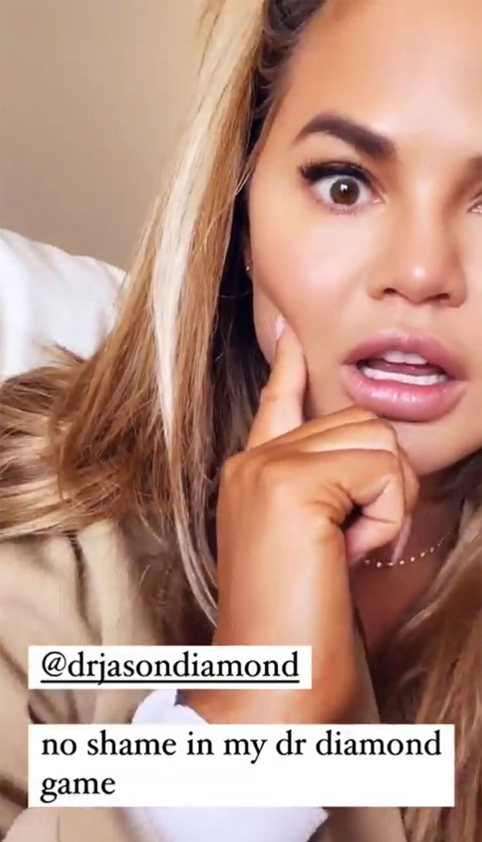 Chrissy Teigen reveals she had fat removed from her cheeks