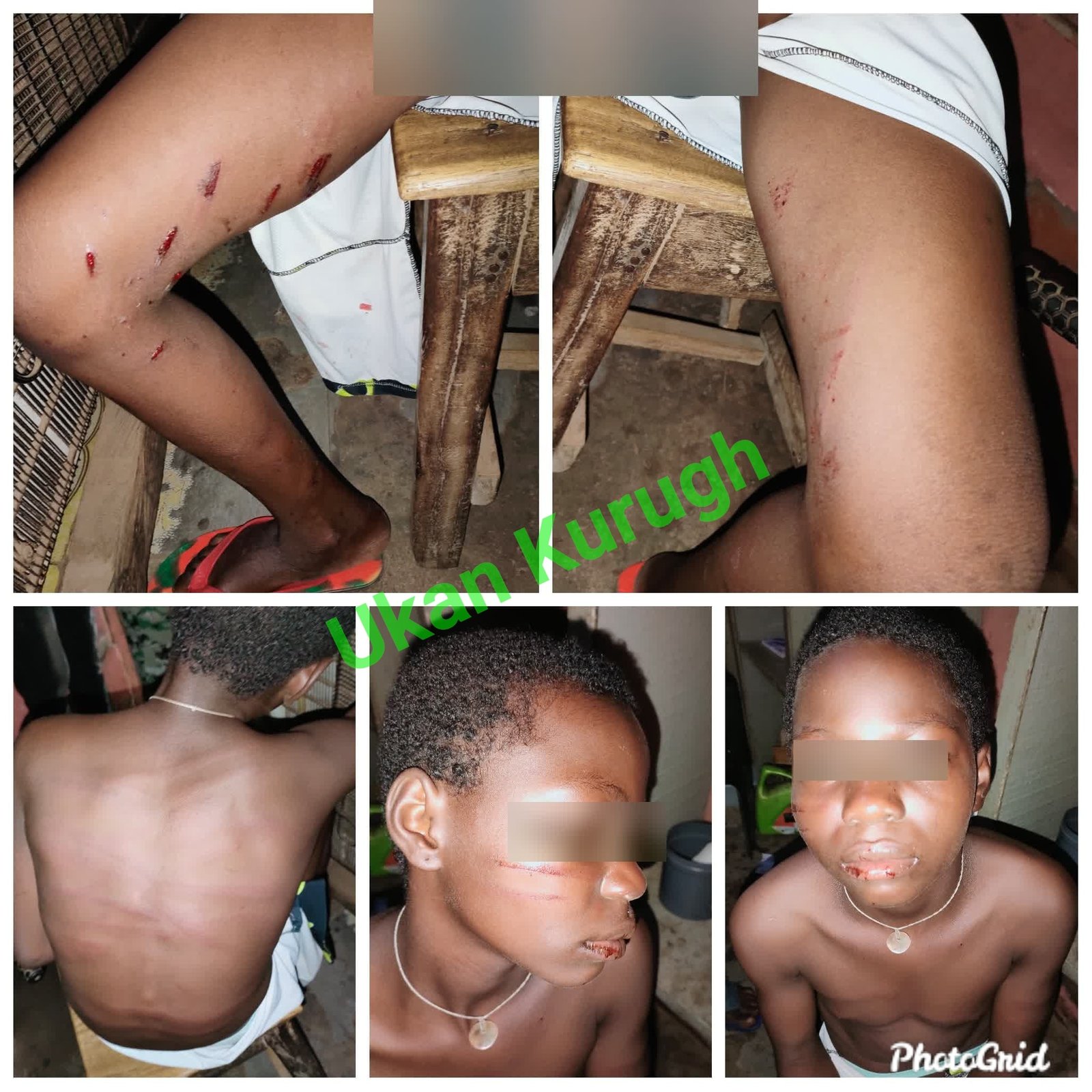 Girl allegedly battered by her stepsister in Benue (photos)