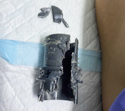 Man gets his pen*s stuck in tube after masturbat*ng with it to see if his enlargement procedure had worked (photos) 