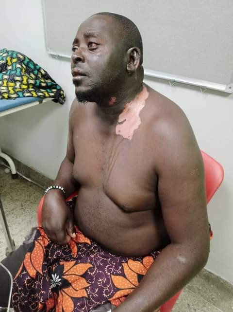 Woman pours hot cooking oil on her husband (video)