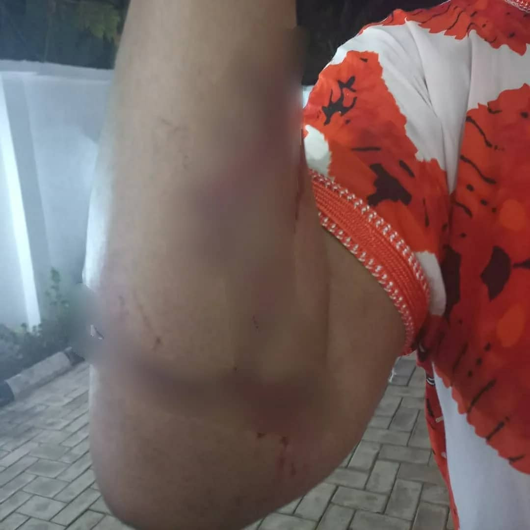 Actress Kemi Afolabi injured and her car vandalized after she was attacked by traffic robbers in Lagos last night (photos and video)