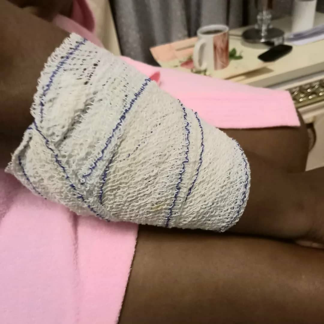 Actress Kemi Afolabi injured and her car vandalized after she was attacked by traffic robbers in Lagos last night (photos and video)