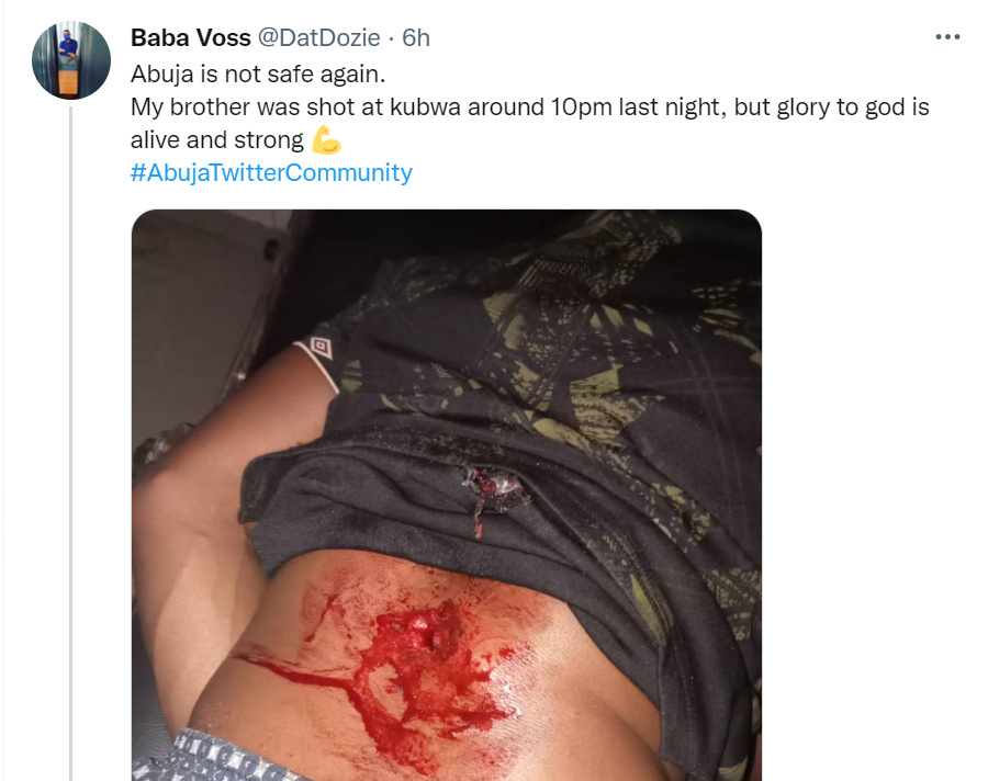 Man shot by gunmen in Abuja 