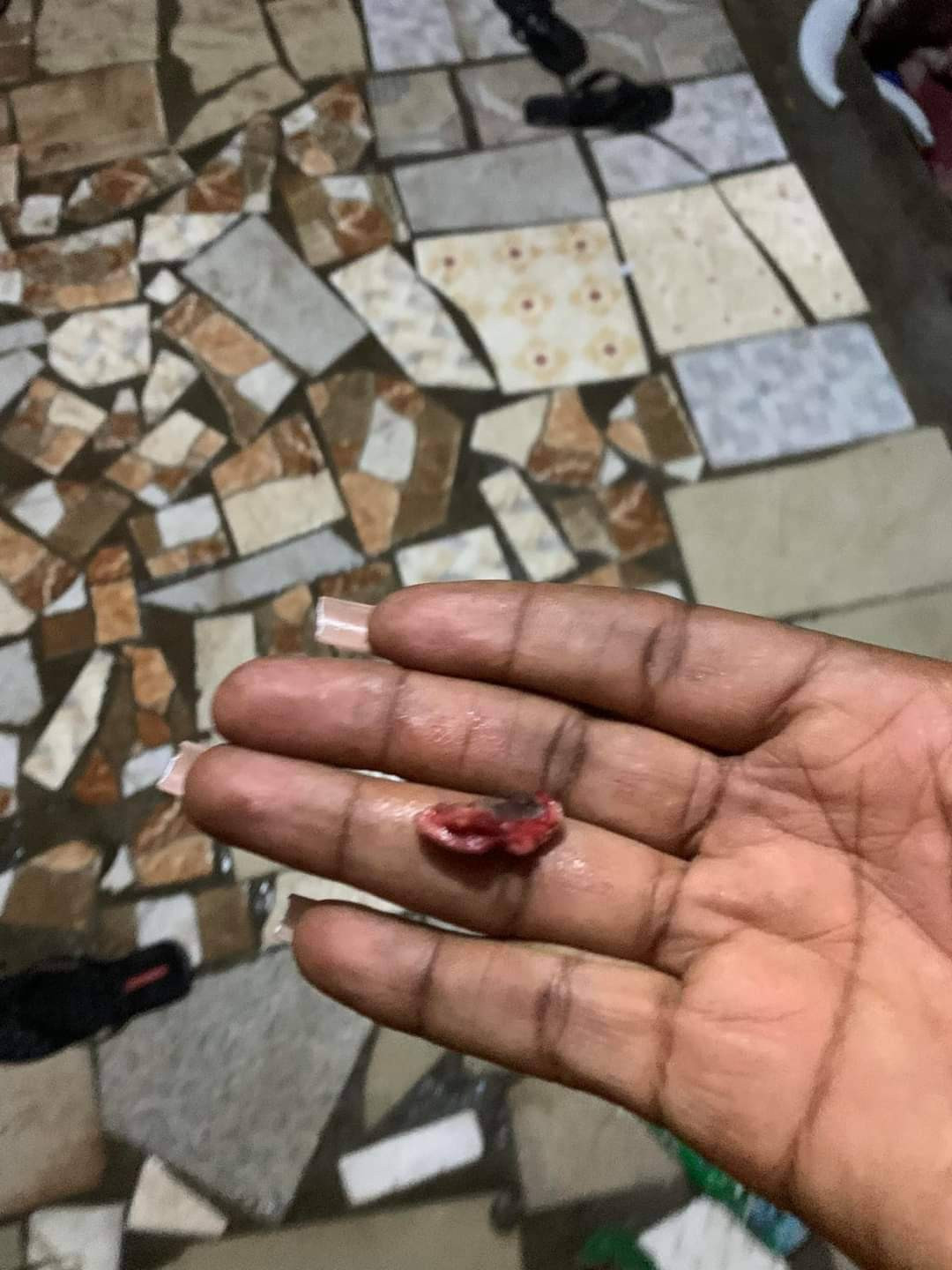 Husband allegedly bites off his wife