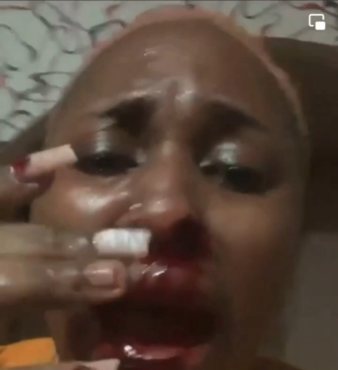 Husband allegedly bites off his wife