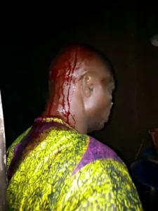 Many Injured As APC, PDP Supporters Clash In Oyo – Photos